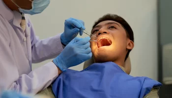 Composite Fillings: A Natural-Looking Way to Treat Cavities